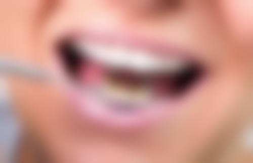 五、阿拉尔旭辉口腔诊所收费价格表