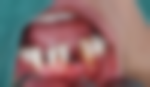 八、鹤岗市人民医院口腔外科怎么预约？