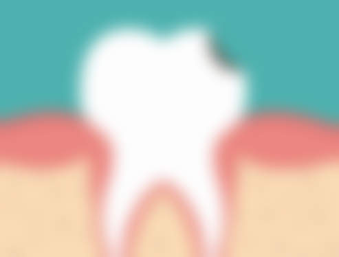 居家缓解牙齿敏感的方法