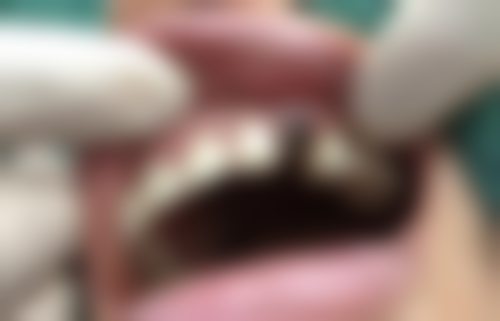 四、南充爱心口腔何琴医生坐诊医院