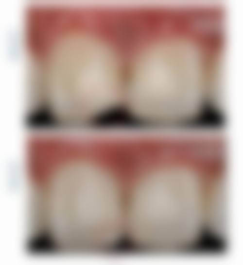 四、山东聊城优美口腔特色项目