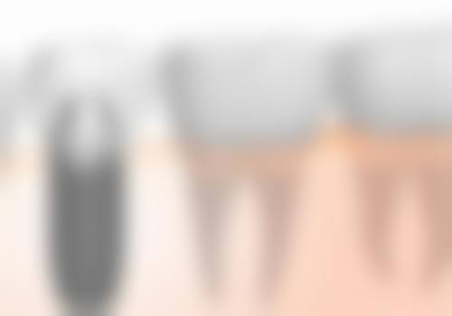 五、扬州牙管家口腔收费价格表