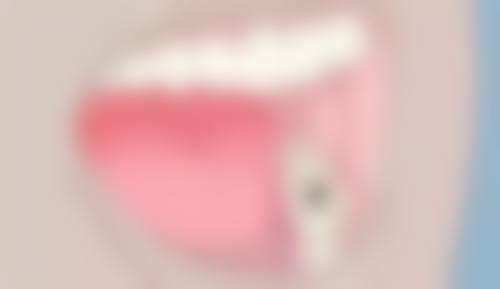 四、六盘水洁诚牙科特色项目