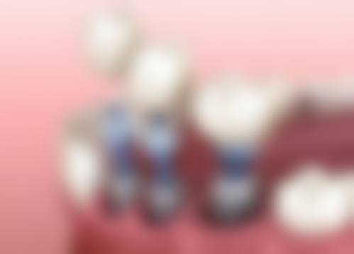 六、六盘水洁诚牙科口碑如何？