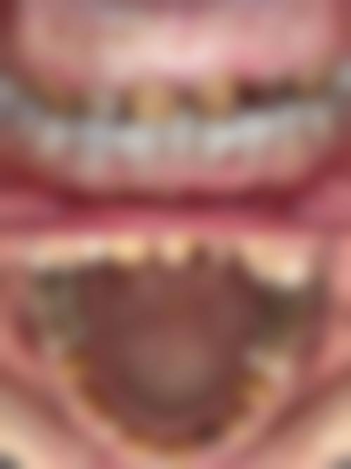 六、内蒙古自治区妇幼保健院口腔科口碑如何？