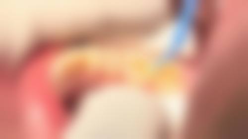 六、温州瑞安黄鹏口腔口碑如何？