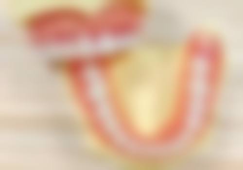 为啥做完根管治疗还有根尖炎？这可能与治疗不完善、咬合问题、个人习惯等多种因素有关！ 