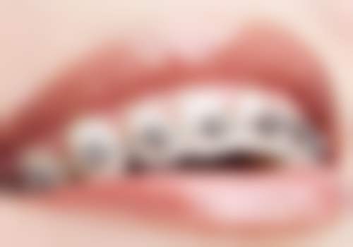 四、浙江杭州品凯口腔（盈佳店）特色项目