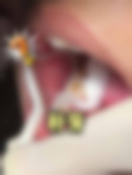 四、广东广州蔡记口腔特色项目