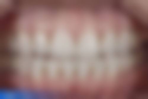 四、陕西延安白舒美口腔诊所特色项目