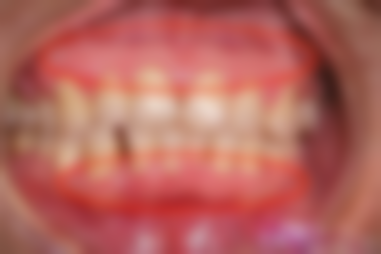 牛奶——富含钙质的营养饮品