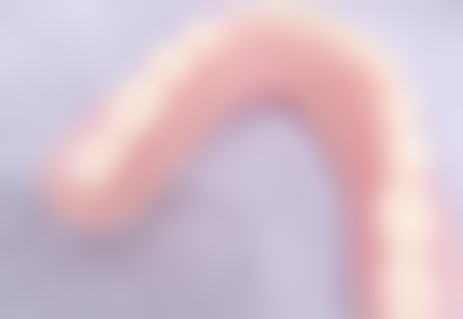 拔牙伤到牙神经可以自愈吗？轻微损伤多可自愈，严重损伤难自愈，治疗方法大不同！ 