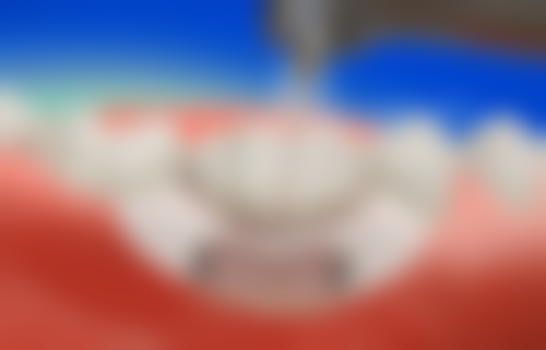 用药对姨妈刚结束拔牙的影响