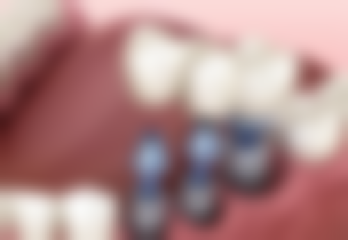 二、江苏苏州昆山臻城口腔正规吗？来看医院资质信息