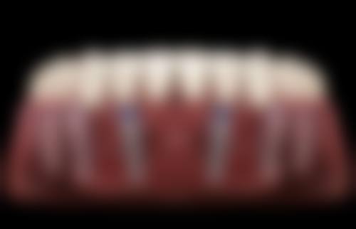 五、武汉瑞尔雅口腔收费价格表