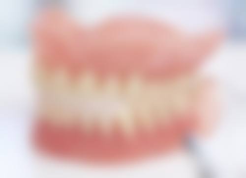 国产自锁金属托槽矫正的过程与注意事项