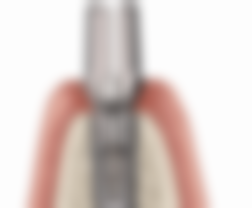 拔牙前要注意什么事项？从身体状态、口腔准备到医疗检查等多方面，一文为你讲清！ 