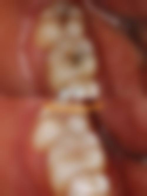 六、茂名市电白区佰年口腔口碑如何？