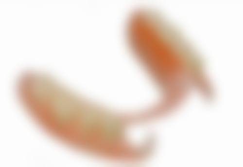 做根管治疗的牙齿一定要做牙套吗？不能一概而论，需综合多因素判断，这里有详细解答！ 