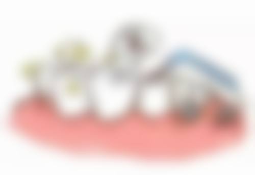 北京京大博爱口腔门诊部进口自锁金属托槽矫正个性化方案保护成效