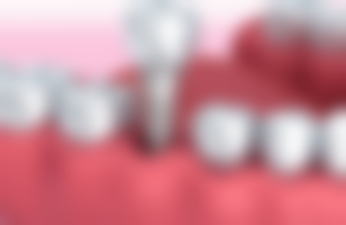 五、雅贝康口腔诊所收费价格表