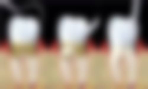 五、昆明柏德口腔黄永康医生技术怎么样？