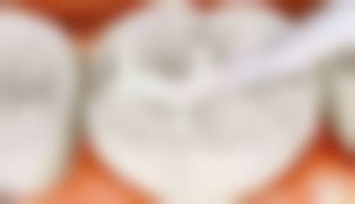 六、湖南长沙市叶子口腔口腔口碑如何？