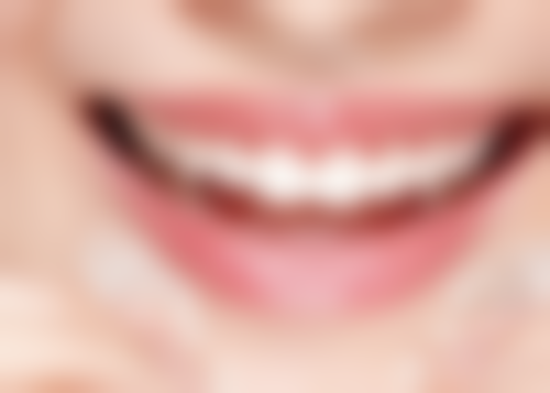 深覆盖矫正需要拔牙吗?这取决于患者具体情况，部分可免拔牙，严重时拔牙或成必要手段！ 