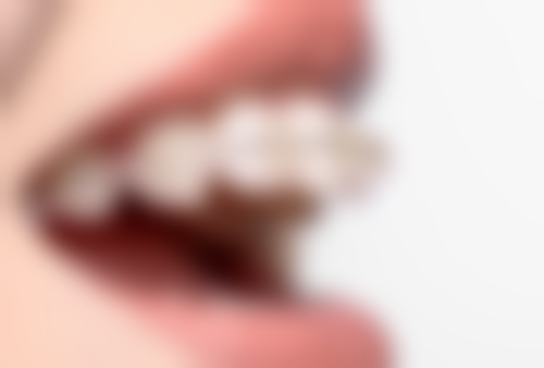 瑞士种植牙：工艺不错，技术精良