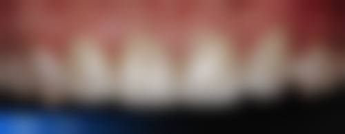 四、云南大理祥云愽爱口腔医院口腔科特色项目