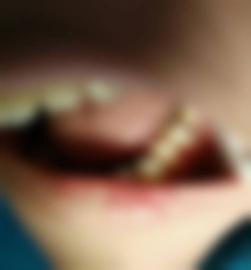 八、湖南长沙市叶子口腔口腔怎么预约？