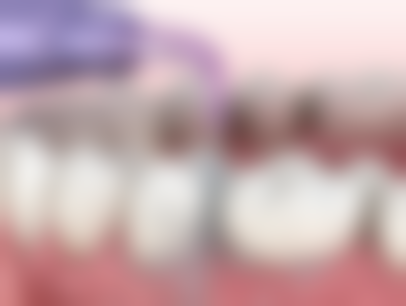 四、湖南长沙市叶子口腔口腔特色项目