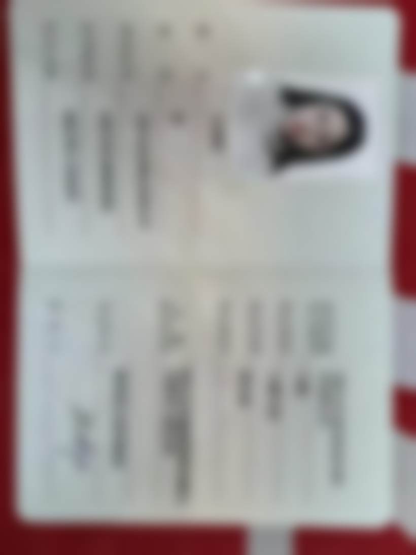 石家庄齿度裕华口腔诊所安卓健+爱尔创种植牙的价格优势