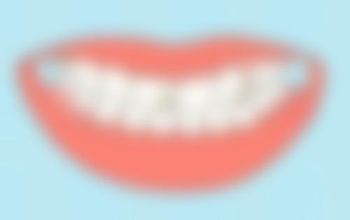 种植牙和隐形义齿的优点