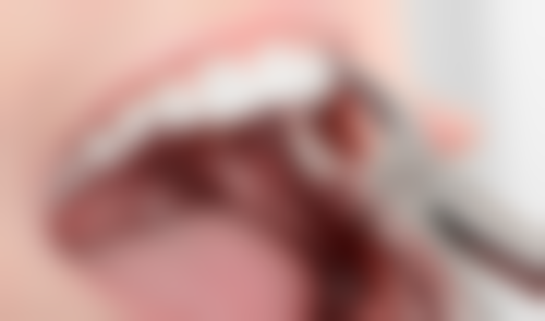 五、丰泽维乐口腔门诊部收费价格表