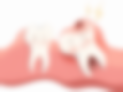 二氧化锆是最好的烤瓷牙吗？并非绝对，不同烤瓷牙各有优势，需综合情况理性选择！ 