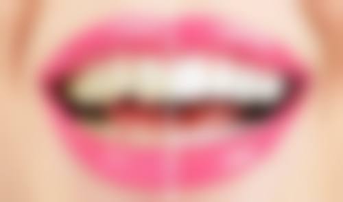 四、武汉缀美口腔门诊部特色项目