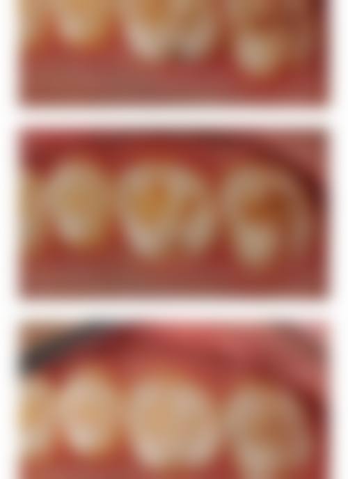 四、武汉康承贝健口腔(新华路1911分院)特色项目