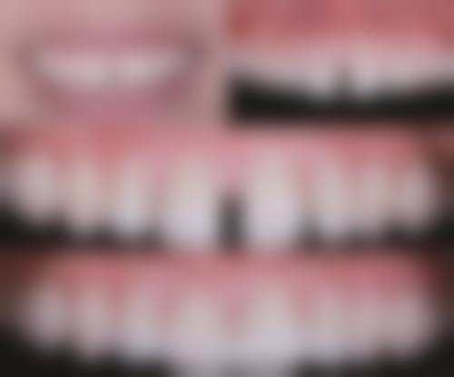 五、武汉缀美口腔门诊部收费价格表