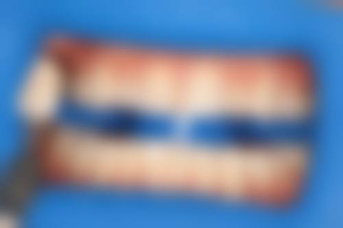 五、绵阳晞恩贝齿口腔医院收费价格表