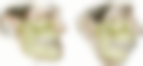 六、山东凯旋美奥张晋兢医生口碑评价及真人实例反馈