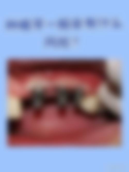 四、山东潍坊朱秀玲口腔特色项目