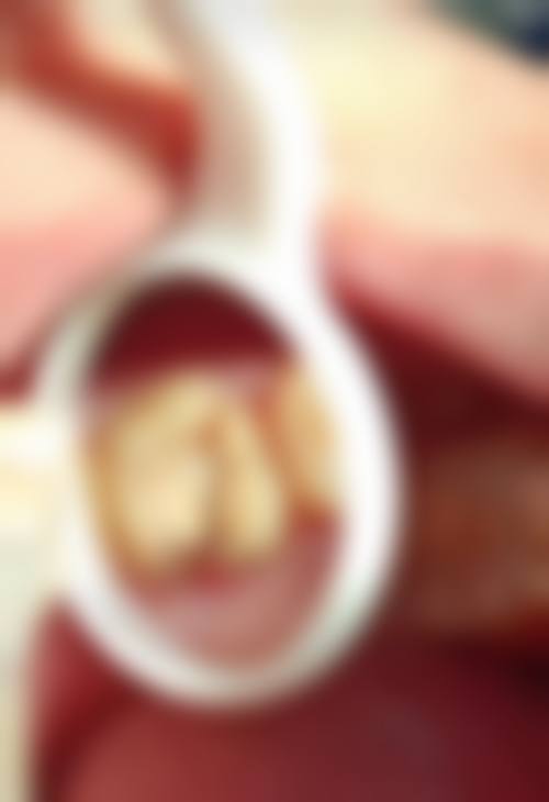 五、苏州家齿口腔（吴中店）收费价格表