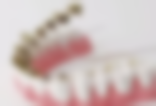 如何减轻洗牙的不适