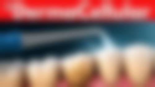 四、六盘水朗朗口腔门诊部特色项目