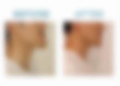 二、北京禾禾口腔李志鹏医生擅长项目