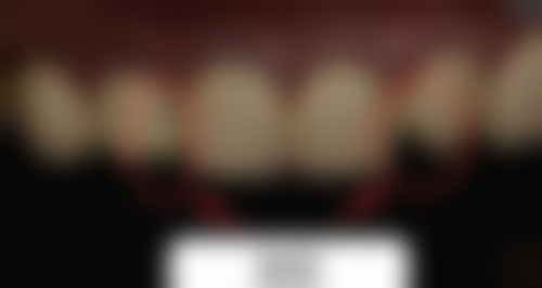 六、无锡金尚口腔门诊部口碑如何？