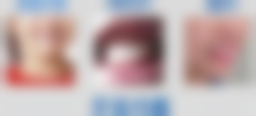 70岁老人种植牙：谨慎评估，仍有机会