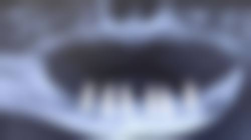 四、河北邢台兴诺口腔特色项目