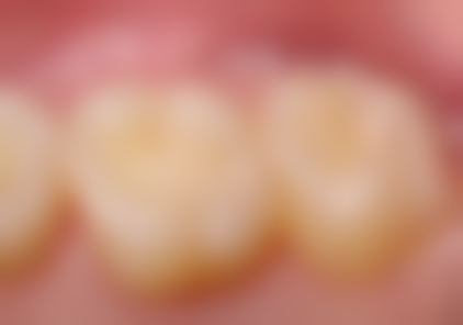 八、来宾周波洁美口腔诊所怎么预约？